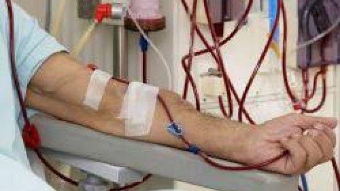 Hemodiyaliz Tedavisi Hakkında Hastaların En Çok Sorduğu Sorular
